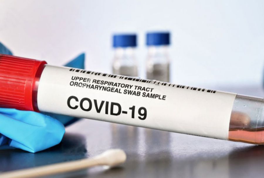 В Московской области трудовых мигрантов будут тестировать на коронавирус